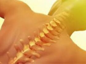 osteochondrosis - ជំងឺឆ្អឹងខ្នង