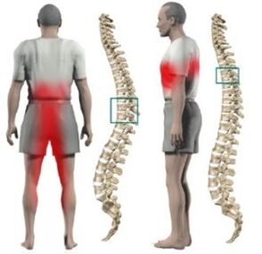 Protrusions នៅក្នុងឆ្អឹងខ្នង